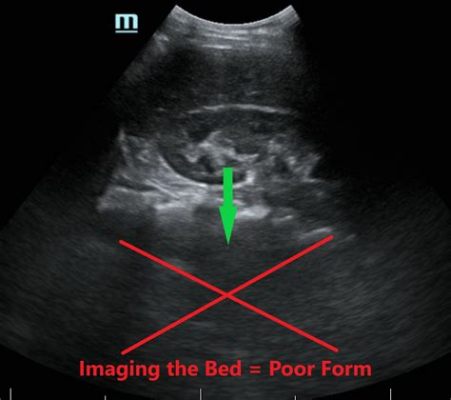 Where to Print Ultrasound Pictures: An In-depth Analysis with Multiple Perspectives